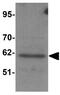 Karyopherin Subunit Alpha 1 antibody, GTX31811, GeneTex, Western Blot image 