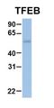 Transcription Factor EB antibody, orb330957, Biorbyt, Western Blot image 