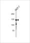Cadherin 1 antibody, LS-C203946, Lifespan Biosciences, Western Blot image 