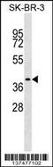 Translocation Associated Membrane Protein 1 antibody, 59-452, ProSci, Western Blot image 