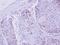 Zinc Finger Protein 530 antibody, NBP2-21023, Novus Biologicals, Immunohistochemistry paraffin image 