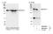 Rho Associated Coiled-Coil Containing Protein Kinase 1 antibody, NB100-624, Novus Biologicals, Western Blot image 