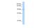 Oncostatin M Receptor antibody, PA5-42870, Invitrogen Antibodies, Western Blot image 