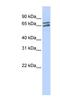 Poly(A) Polymerase Gamma antibody, NBP1-57230, Novus Biologicals, Western Blot image 