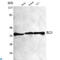 Nucleophosmin 1 antibody, LS-C812886, Lifespan Biosciences, Western Blot image 