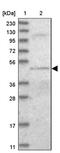 DALR Anticodon Binding Domain Containing 3 antibody, PA5-57850, Invitrogen Antibodies, Western Blot image 