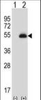 Paired Box 6 antibody, LS-C163392, Lifespan Biosciences, Western Blot image 