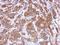 Murine Retrovirus Integration Site 1 Homolog antibody, GTX123277, GeneTex, Immunohistochemistry paraffin image 