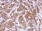 Irag antibody, GTX123277, GeneTex, Immunohistochemistry paraffin image 