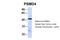 Proteasome 26S Subunit, Non-ATPase 4 antibody, 27-133, ProSci, Western Blot image 