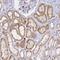 Solute Carrier Family 26 Member 1 antibody, NBP1-84897, Novus Biologicals, Immunohistochemistry frozen image 