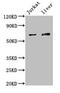 Kelch Like Family Member 2 antibody, CSB-PA012421LA01HU, Cusabio, Western Blot image 