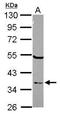 ElaC Ribonuclease Z 1 antibody, GTX118123, GeneTex, Western Blot image 