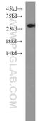 Proteasome Subunit Alpha 6 antibody, 11573-1-AP, Proteintech Group, Western Blot image 