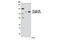 RB Transcriptional Corepressor 1 antibody, 8516S, Cell Signaling Technology, Western Blot image 