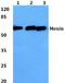 Menin 1 antibody, A00331, Boster Biological Technology, Western Blot image 