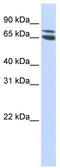 Zinc Finger And BTB Domain Containing 48 antibody, TA344490, Origene, Western Blot image 