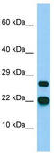 Basic Transcription Factor 3 Like 4 antibody, TA331631, Origene, Western Blot image 