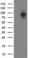 Protein Kinase C Epsilon antibody, TA502438, Origene, Western Blot image 