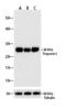 Troponin I1, Slow Skeletal Type antibody, 710580, Invitrogen Antibodies, Western Blot image 