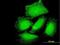 Protein Phosphatase 1 Regulatory Subunit 3B antibody, H00079660-B01P, Novus Biologicals, Immunofluorescence image 