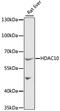 Histone Deacetylase 10 antibody, 22-044, ProSci, Western Blot image 