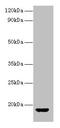 Arginine Vasopressin antibody, LS-C317874, Lifespan Biosciences, Western Blot image 