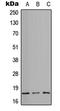 Integrin Subunit Alpha 5 antibody, LS-C354347, Lifespan Biosciences, Western Blot image 