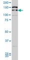 Tripartite Motif Containing 33 antibody, H00051592-M02, Novus Biologicals, Western Blot image 