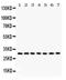 NAD(P)H Quinone Dehydrogenase 1 antibody, PB9497, Boster Biological Technology, Western Blot image 