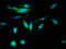 Butyrylcholinesterase antibody, LS-C669892, Lifespan Biosciences, Immunofluorescence image 