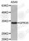 G Protein-Coupled Receptor 35 antibody, A3602, ABclonal Technology, Western Blot image 