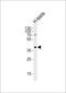 Testis Specific Protein Y-Linked 2 antibody, PA5-72184, Invitrogen Antibodies, Western Blot image 