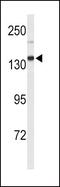 Xanthine Dehydrogenase antibody, PA5-26285, Invitrogen Antibodies, Western Blot image 