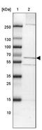 Transmembrane Protein 87A antibody, PA5-53724, Invitrogen Antibodies, Western Blot image 