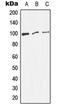 Dynamin 1 antibody, LS-C352122, Lifespan Biosciences, Western Blot image 