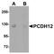 Protocadherin 12 antibody, NBP1-77002, Novus Biologicals, Western Blot image 