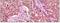 Glycogen Synthase Kinase 3 Alpha antibody, NBP1-47500, Novus Biologicals, Immunohistochemistry paraffin image 
