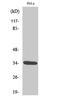 Cyclin Dependent Kinase 2 antibody, A00166T160-1, Boster Biological Technology, Western Blot image 