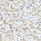 Perilipin 3 antibody, LS-C746771, Lifespan Biosciences, Immunohistochemistry paraffin image 