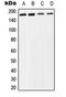 SWI/SNF Related, Matrix Associated, Actin Dependent Regulator Of Chromatin Subfamily C Member 2 antibody, orb224006, Biorbyt, Western Blot image 