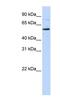 CDP-Diacylglycerol Synthase 1 antibody, NBP1-59495, Novus Biologicals, Western Blot image 