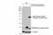 Estrogen Receptor 2 antibody, GTX134663, GeneTex, Western Blot image 