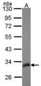 Hes Related Family BHLH Transcription Factor With YRPW Motif Like antibody, GTX114121, GeneTex, Western Blot image 