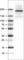 ERBB2 antibody, AMAb90628, Atlas Antibodies, Western Blot image 