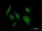 Acyl-CoA Thioesterase 8 antibody, H00010005-B01P, Novus Biologicals, Immunocytochemistry image 