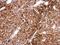 Jade Family PHD Finger 3 antibody, GTX107111, GeneTex, Immunohistochemistry paraffin image 