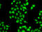 Protein Inhibitor Of Activated STAT 3 antibody, LS-C346210, Lifespan Biosciences, Immunofluorescence image 