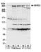 HECT And RLD Domain Containing E3 Ubiquitin Protein Ligase 2 antibody, A301-905A, Bethyl Labs, Western Blot image 