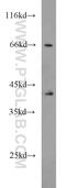 Septin 9 antibody, 10769-1-AP, Proteintech Group, Western Blot image 